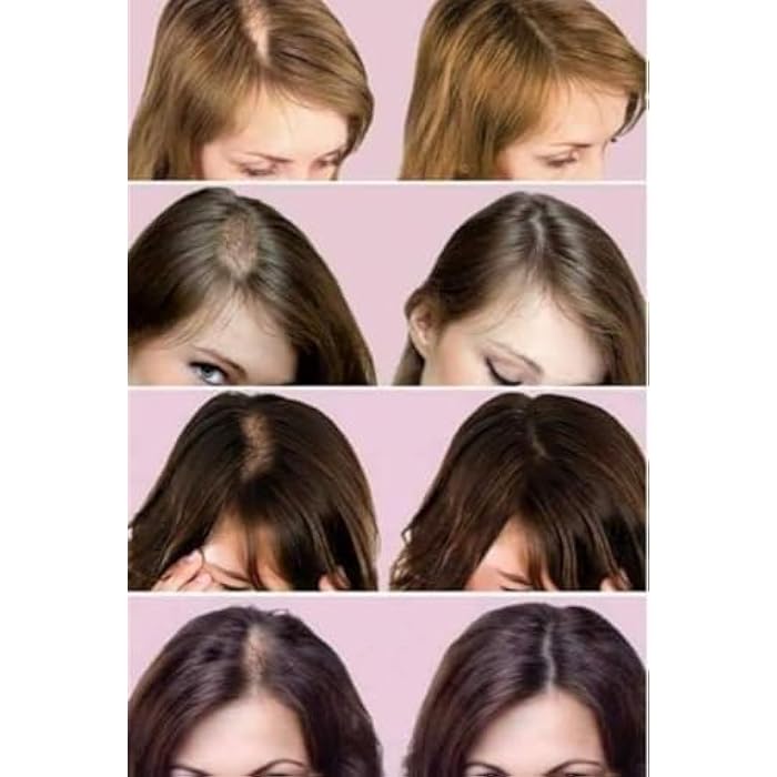 Faster Garlic Set Hair Loss Treatment 5 Pieces Shampoo, Conditioner, Serum, Bath Cream and Ampoule - Image 3